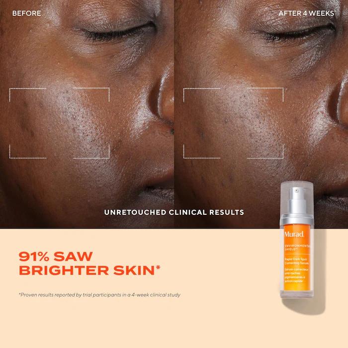 Murad Rapid Dark Spot Correcting Serum with Glycolic and Tranexamic Acid