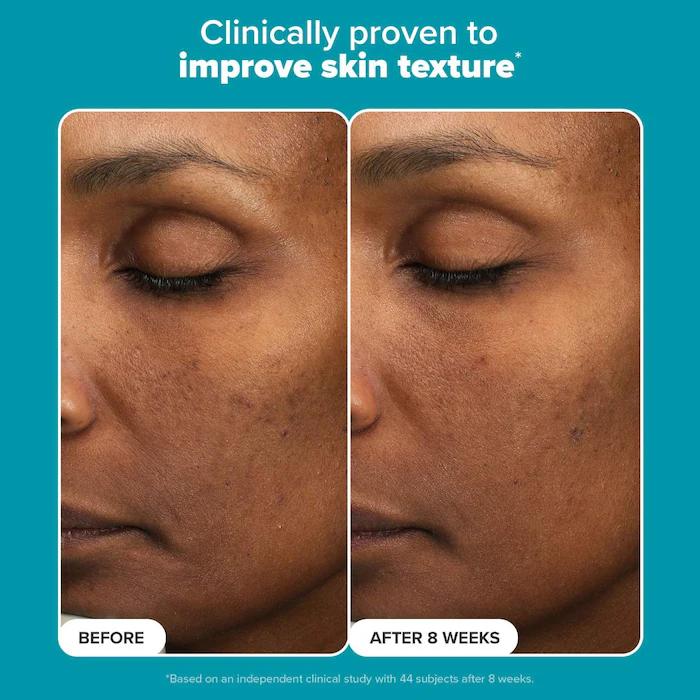 Paula's Choice  6% Mandelic Acid + 2% Lactic Acid AHA Liquid Exfoliant for Dark Spots, Textured Skin