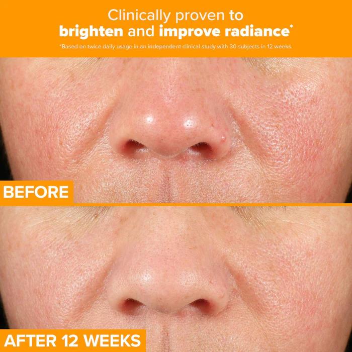 Paula's Choice C15 Super Booster for Brightening Dullness & Uneven