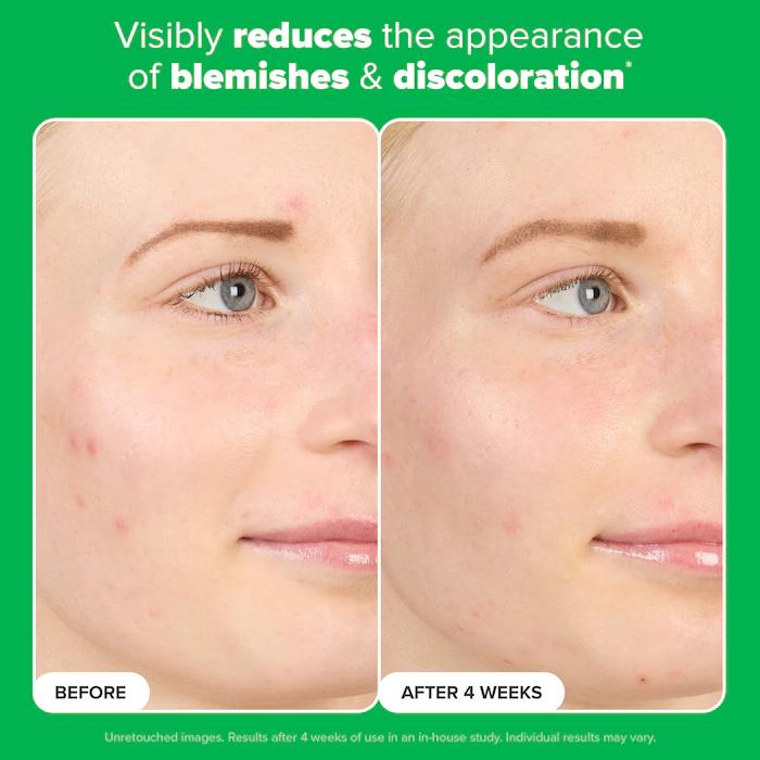 Paula's Choice  10% Azelaic Acid Booster for Redness Relief