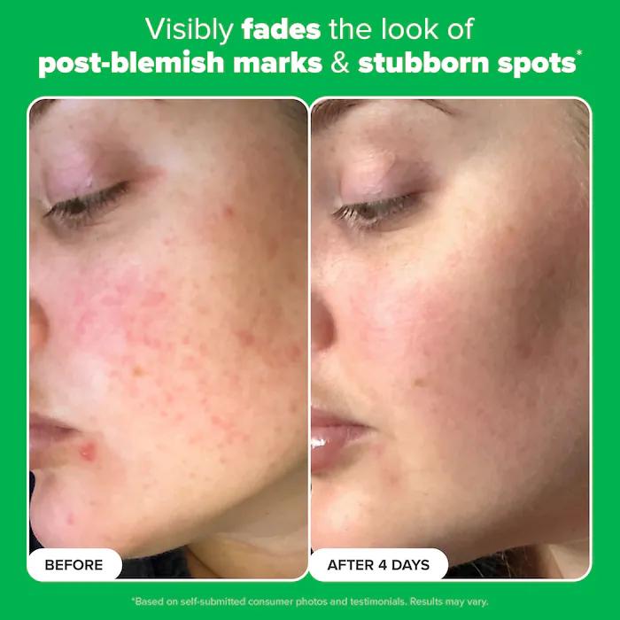 Paula's Choice  10% Azelaic Acid Booster for Redness Relief