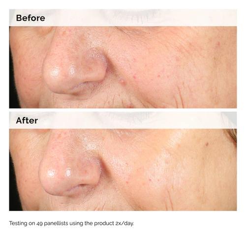 The Ordinary Alpha Arbutin 2% + Hyaluronic Acid for Hyperpigmentation