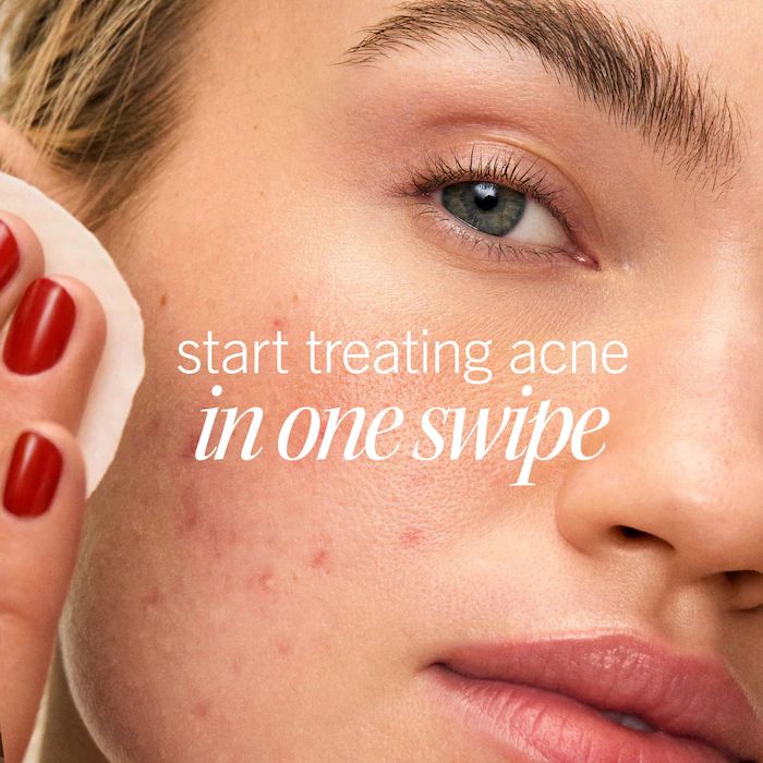 First Aid Beauty Acne Clearing Pads - 2% Salicylic Acid Acne Treatment