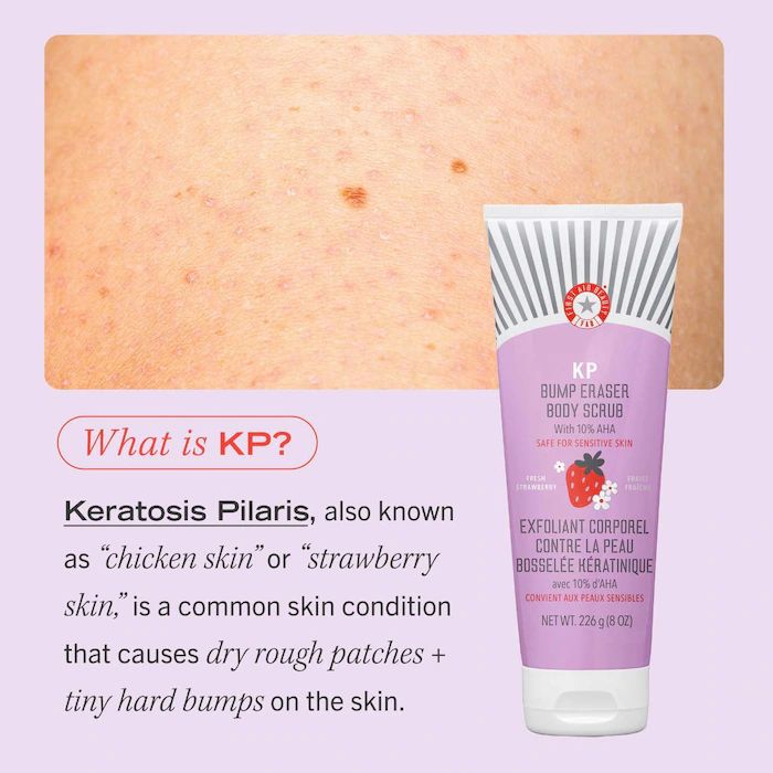 First Aid Beauty KP Bump Eraser Body Scrub with 10% AHA –  Fresh Strawberry