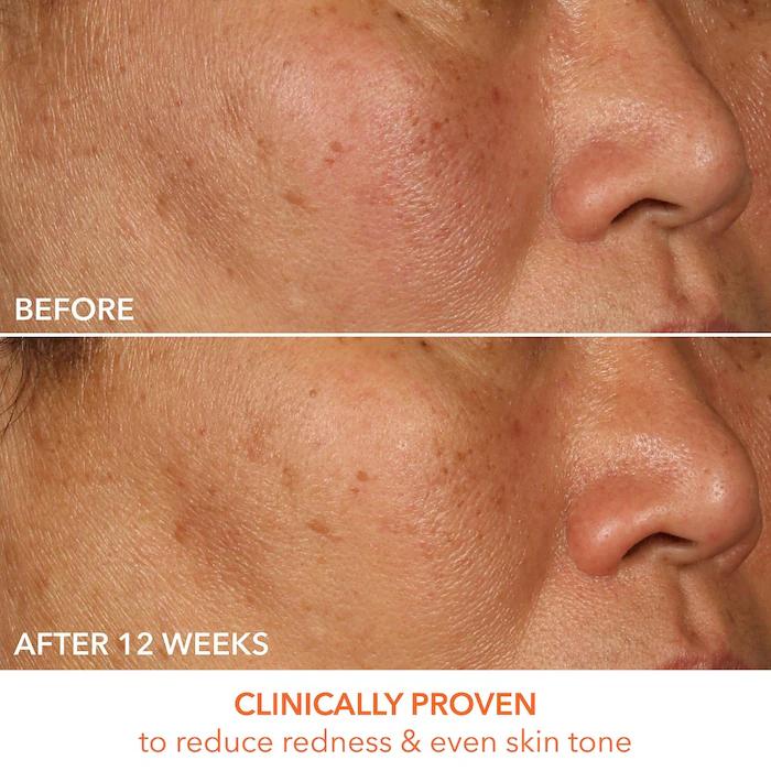 Dr. Dennis Gross Skincare Vitamin C Lactic 15% Firm & Bright Serum