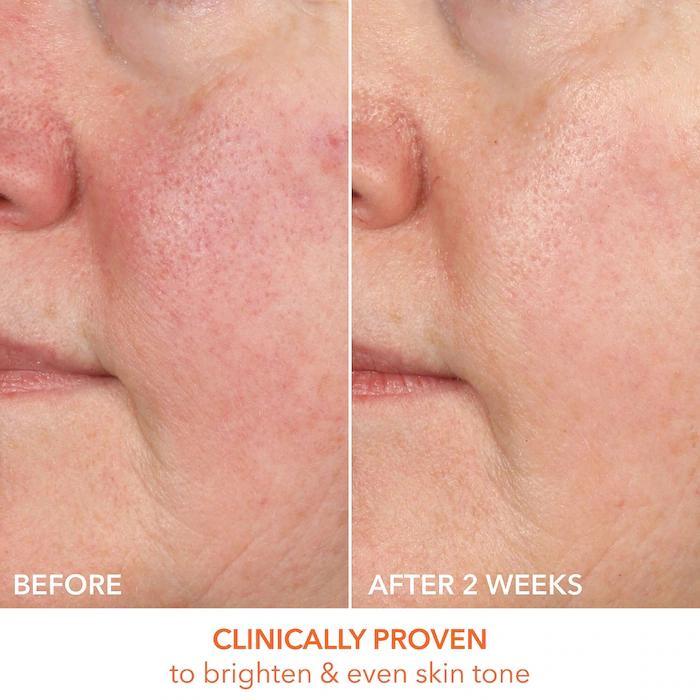 Dr. Dennis Gross Skincare Vitamin C Lactic 15% Firm & Bright Serum